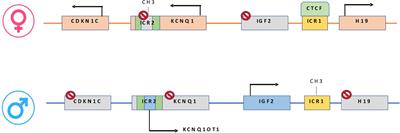Preclinical and Clinical Epigenetic-Based Reconsideration of Beckwith-Wiedemann Syndrome
